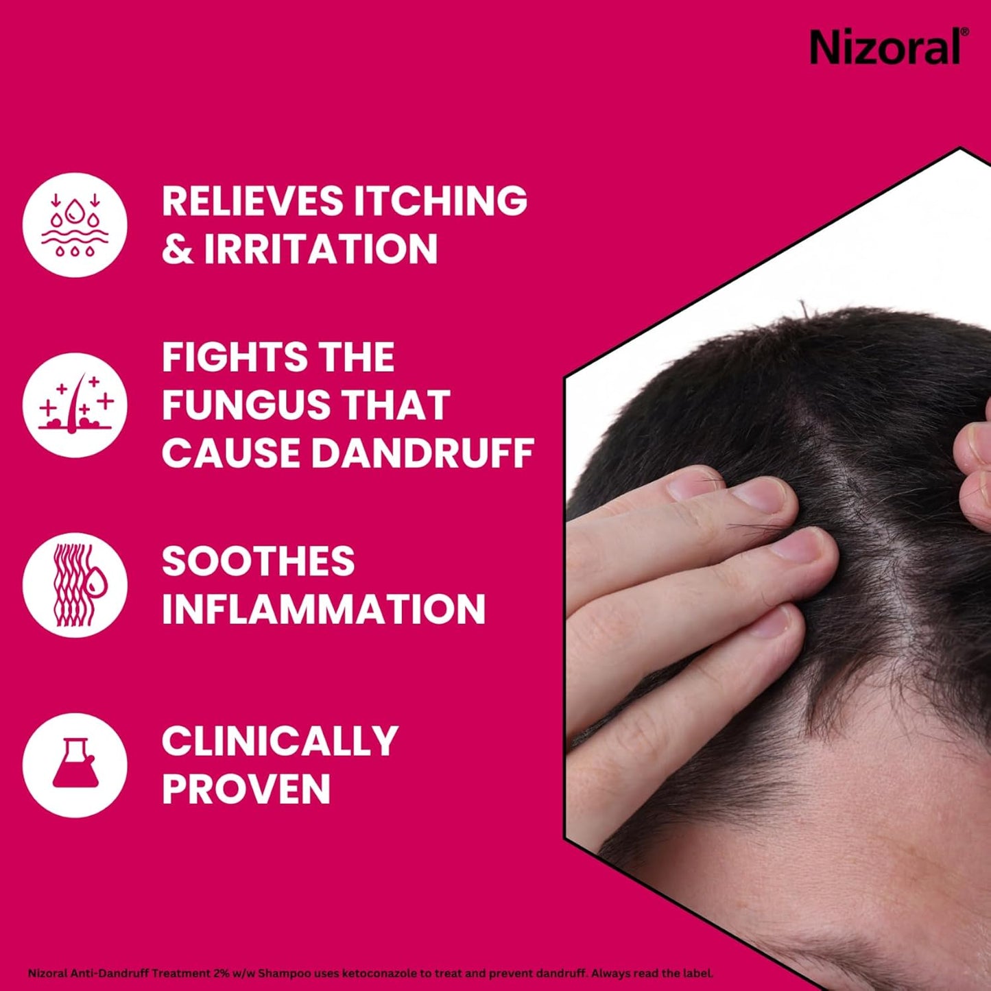 Nizoral Anti-Dandruff Treatment Shampoo, Treats and Prevents Dandruff, Clinically Proven to Control Itchy & Flaky Scalps, Contains Ketoconazole, 1 x 100ml