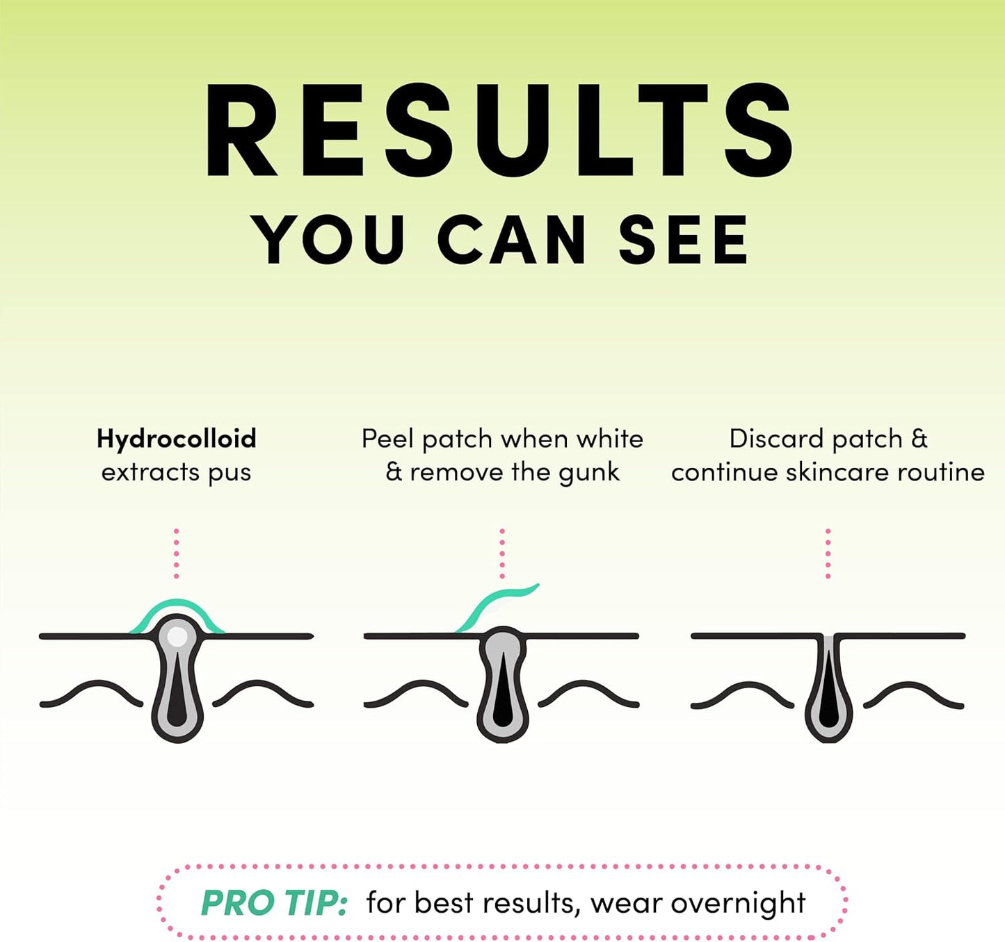 Dots for Spots Pimple Patches, 24 Pack, Translucent Hydrocolloid Spot Treatment Stickers for Face, Vegan and Cruelty-Free, Korean Skin Care"